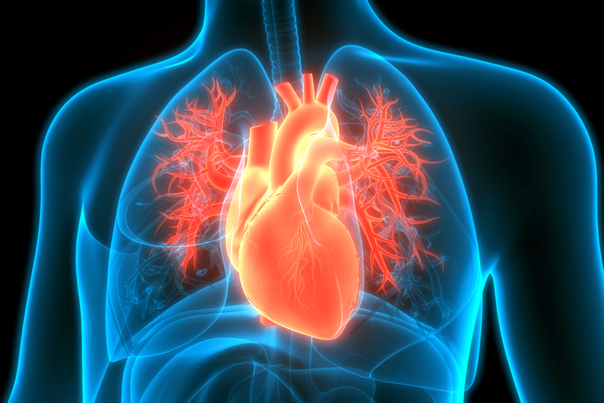 Cardiomegaly Meaning: Definition and Key Facts