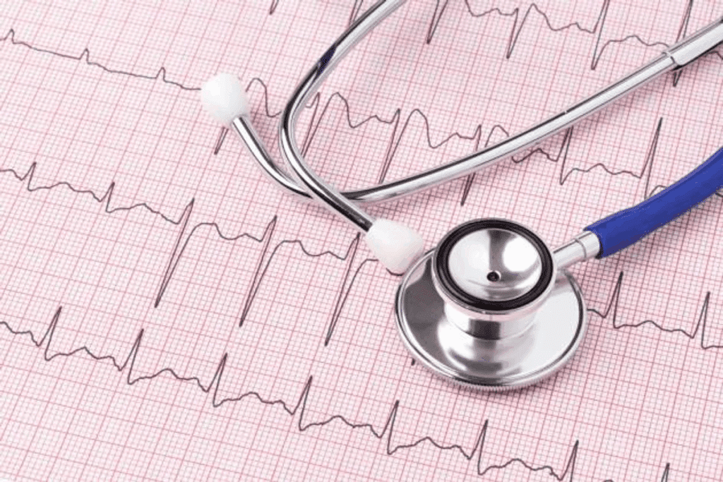 Third Degree Heart Block ECG: 8 Key Findings