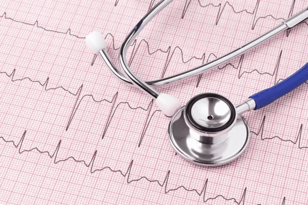 Third Degree Heart Block ECG: 8 Key Findings
