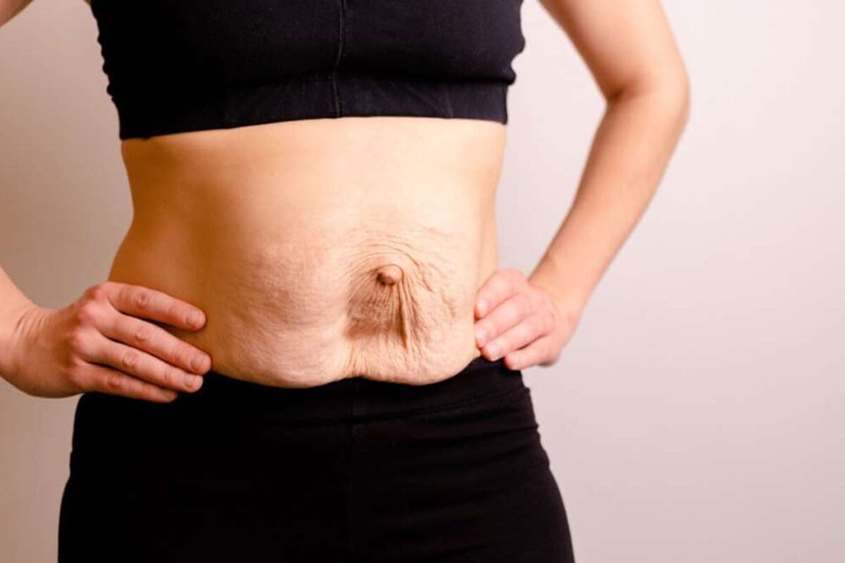 Pain After Hernia Surgery: Answering What Is a Hernia Patient Concerns