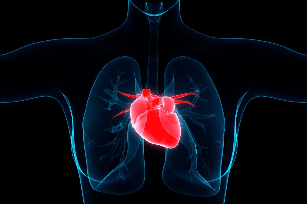 How Long Can You Live With 2 Blocked Arteries