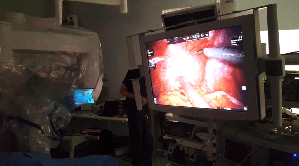 Operate Prostate: Downsides of TURP Surgery