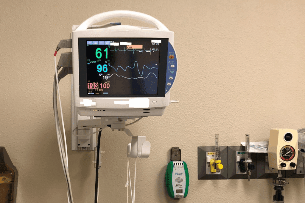 What Is a Heart Monitor? Crucial Facts & Essential Guide