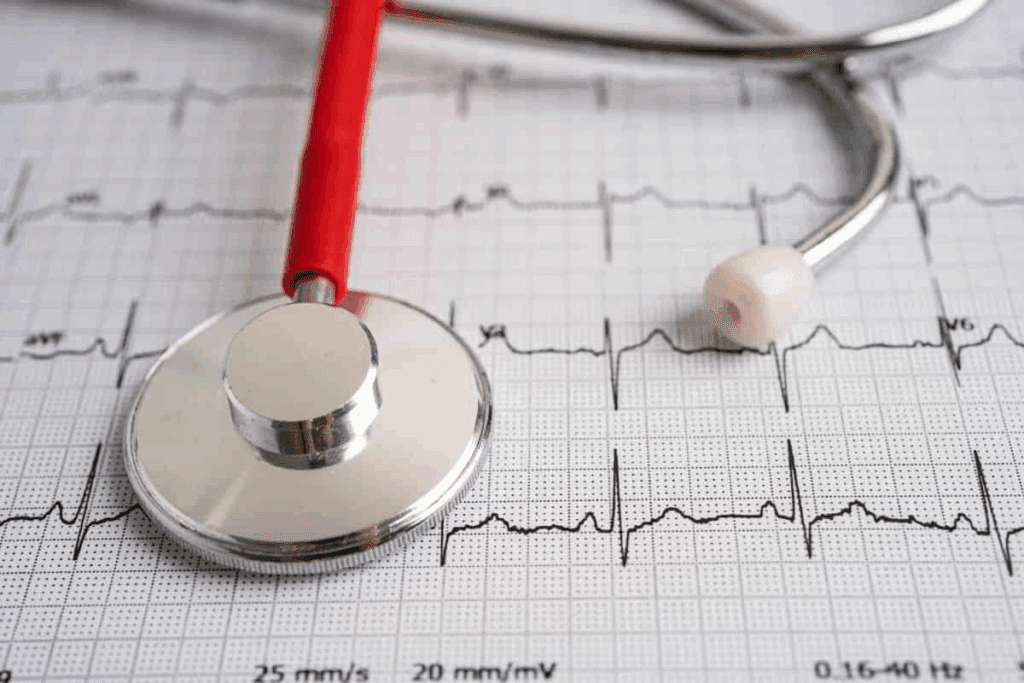 Classes of Antiarrhythmic Drugs Explained