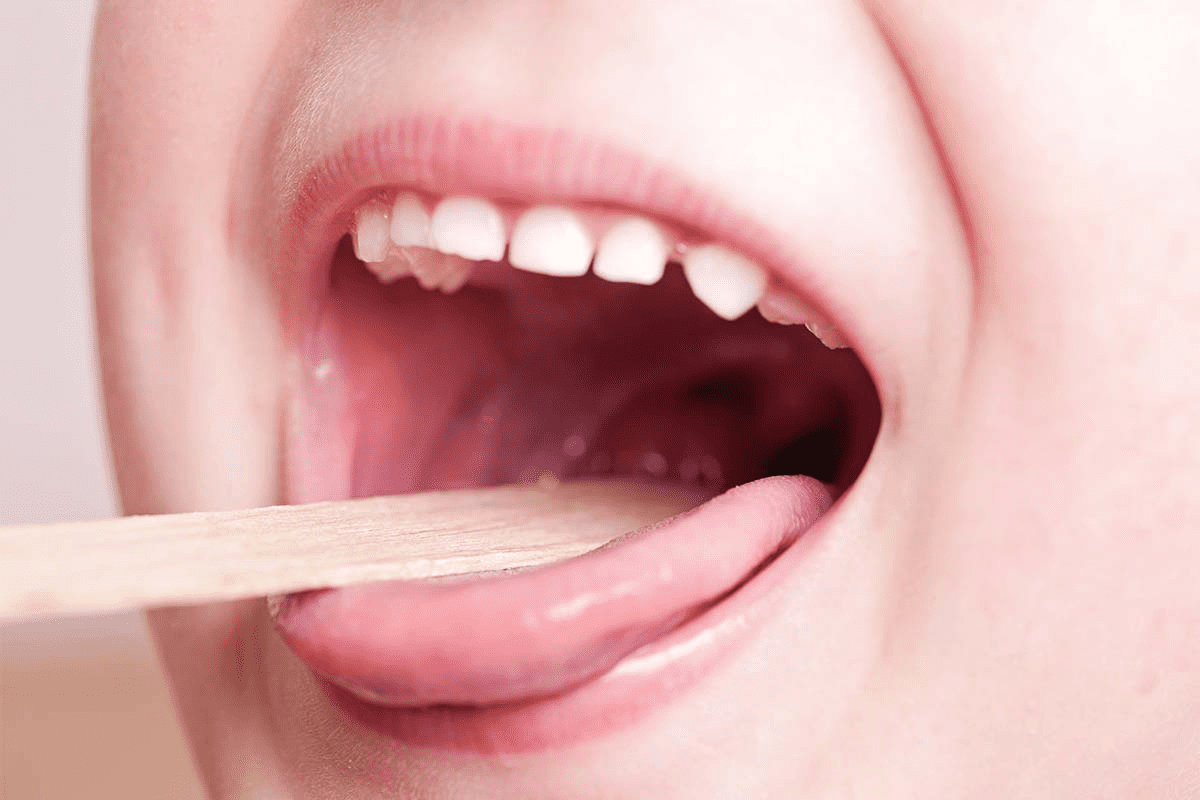 Pus Pockets on Tonsils: Causes & Treatments
