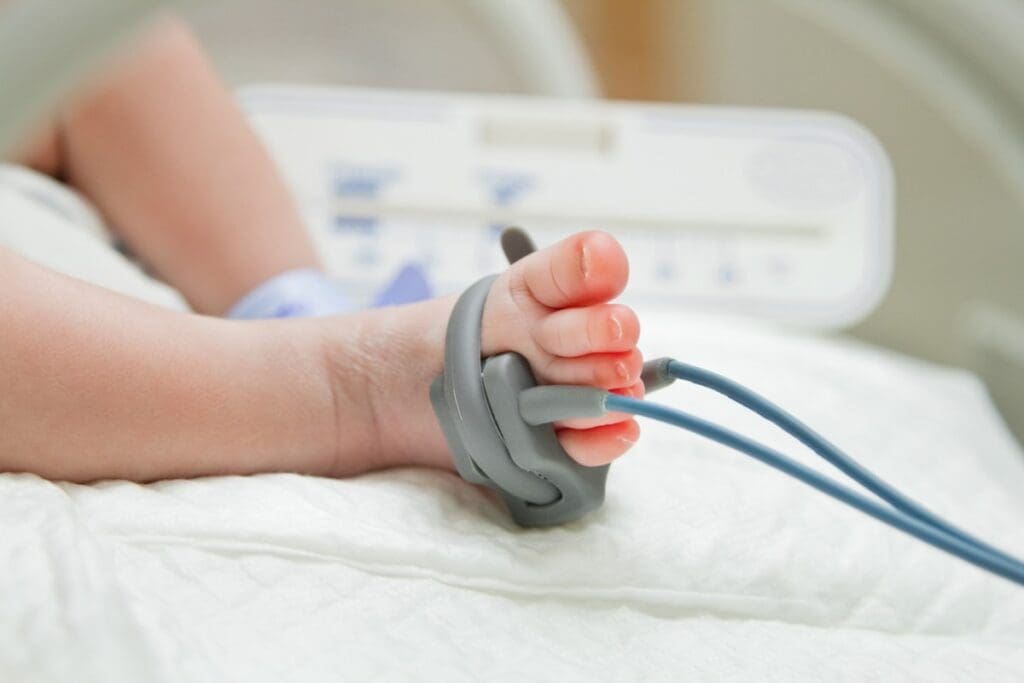 Gender Prevalence in Down Syndrome: What Research Shows