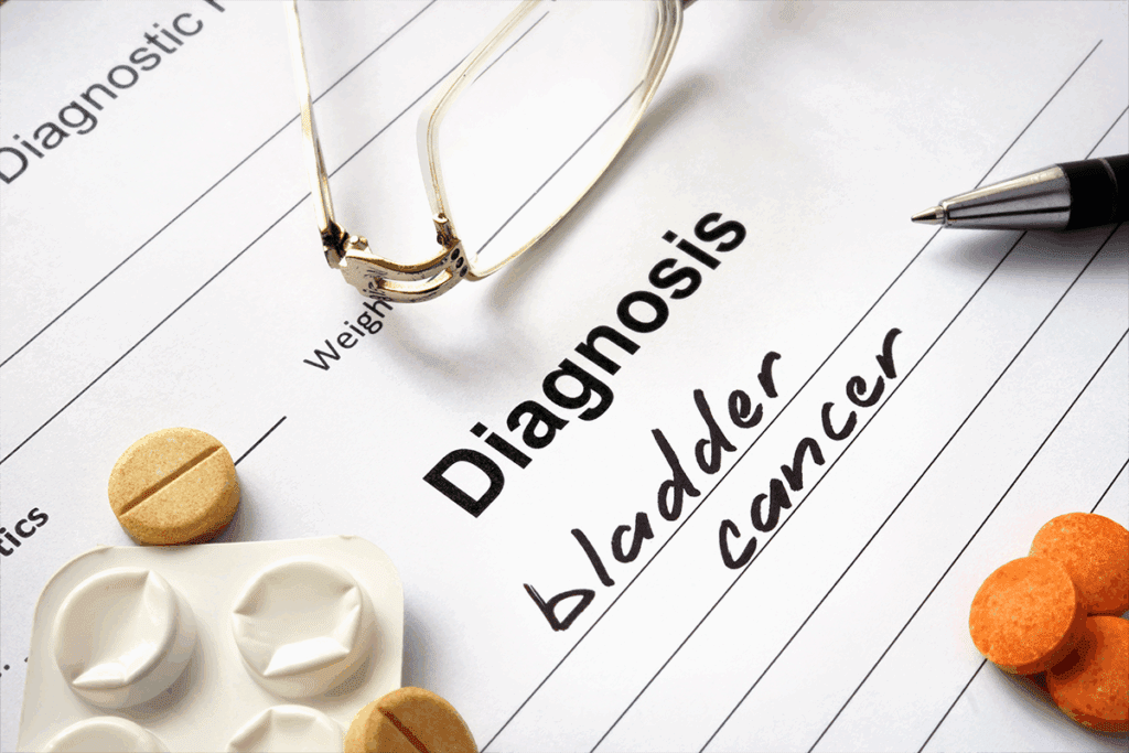 Bladder Cancer Sonography: Complete Ultrasound Guide 3 Can Ultrasound Detect Bladder Cancer? A Complete Guide