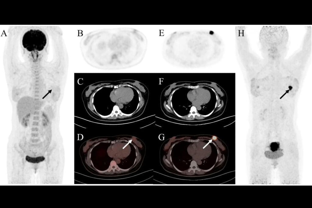 Can a CT What Scan (Urogram) Detect an Infection? 3 Can a CT What Scan (Urogram) Detect an Infection?