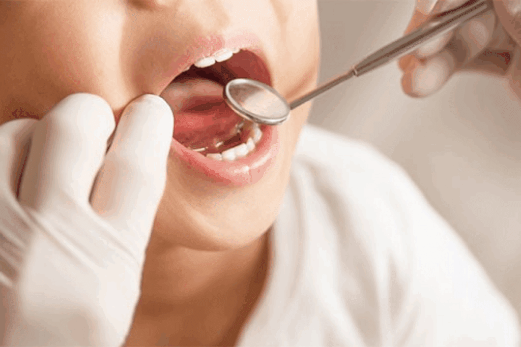 Age Limit for Tonsillectomy: Full Guide