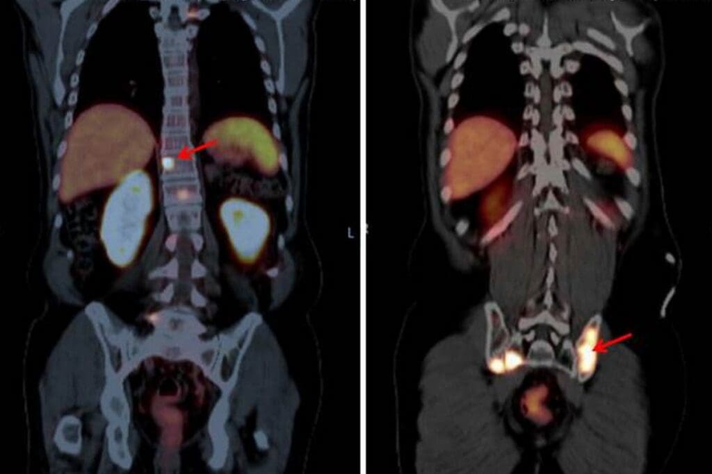 Is a CT Urogram Done With or Without Contrast Dye?