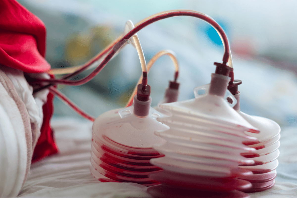 Bloody Sinus Drainage: What It Means