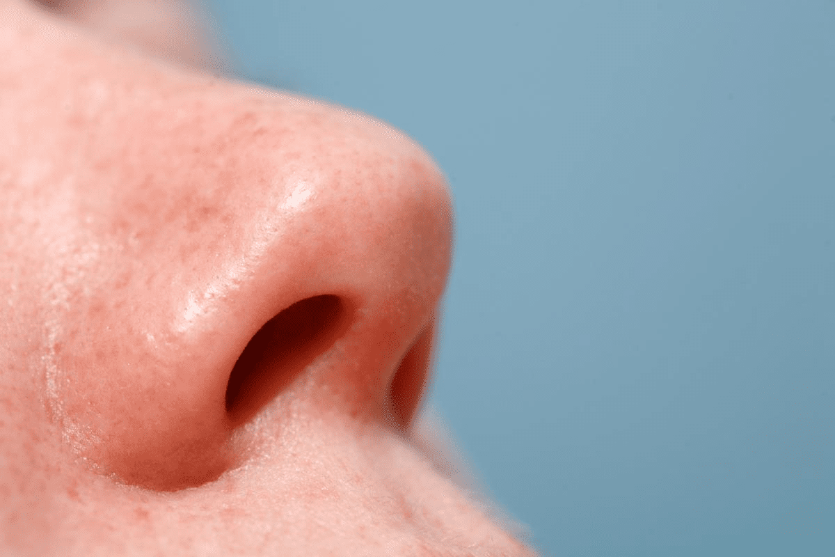Nasal Blood Mucus: Causes and Treatment