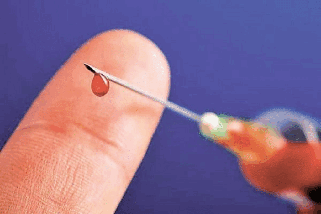 What Does Blood in Pee Look Like? Causes 1 What Does Blood in Pee Look Like? Causes