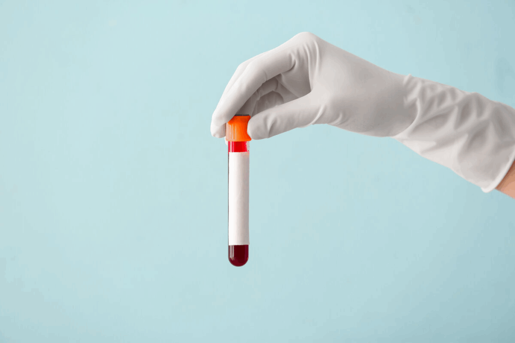 UTI Spotting Blood: Is Bleeding Normal?