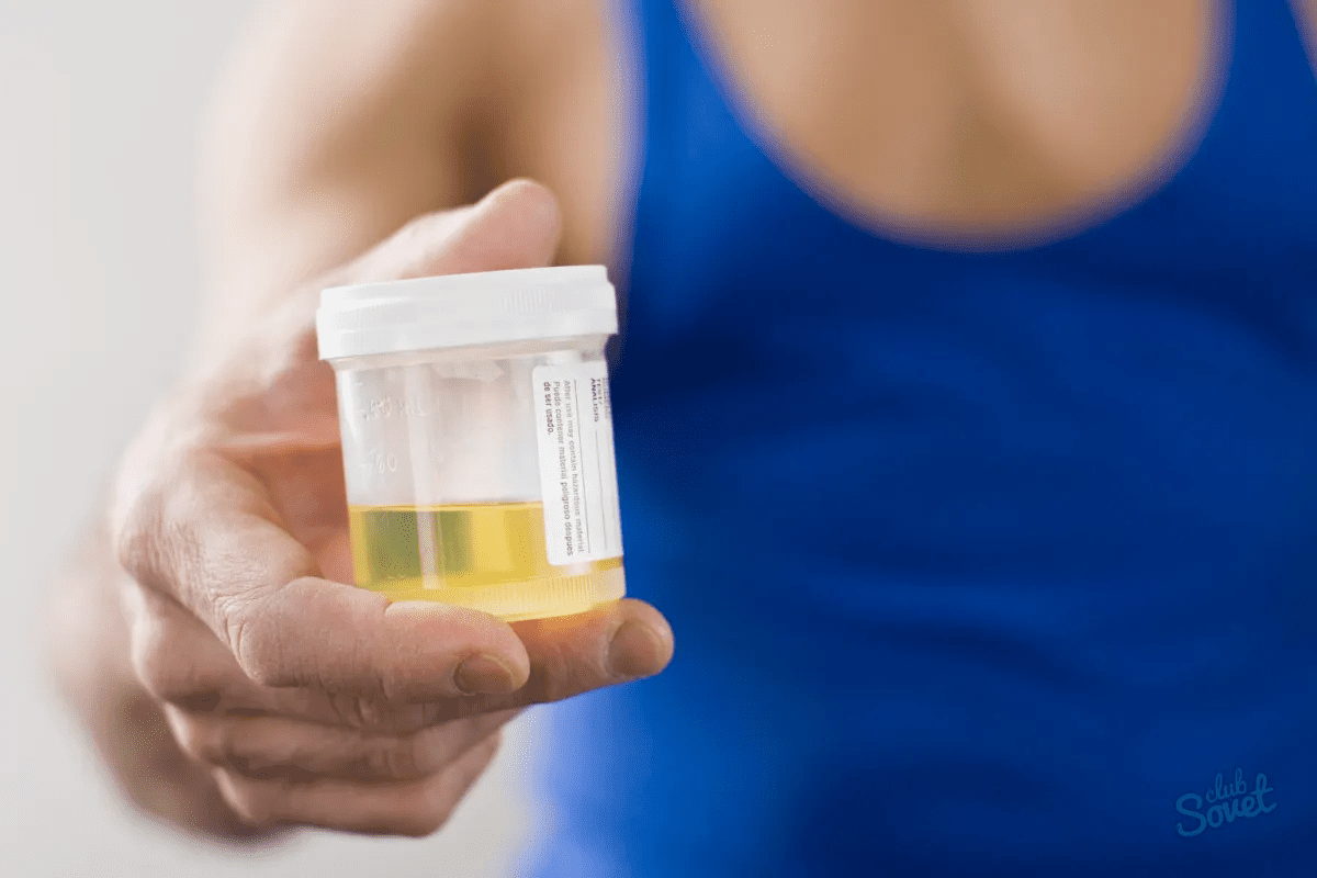 Blood in Urine Male: Causes and When to Seek Help