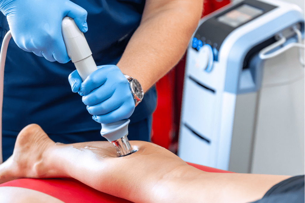 Pain Management: Is Lithotripsy (ESWL) a Painful Procedure? 2 Pain Management: Is Lithotripsy (ESWL) a Painful Procedure?