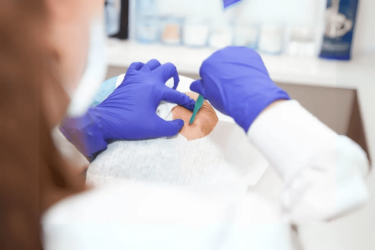 Red Spot on Scalp Cancer: Signs & Guide