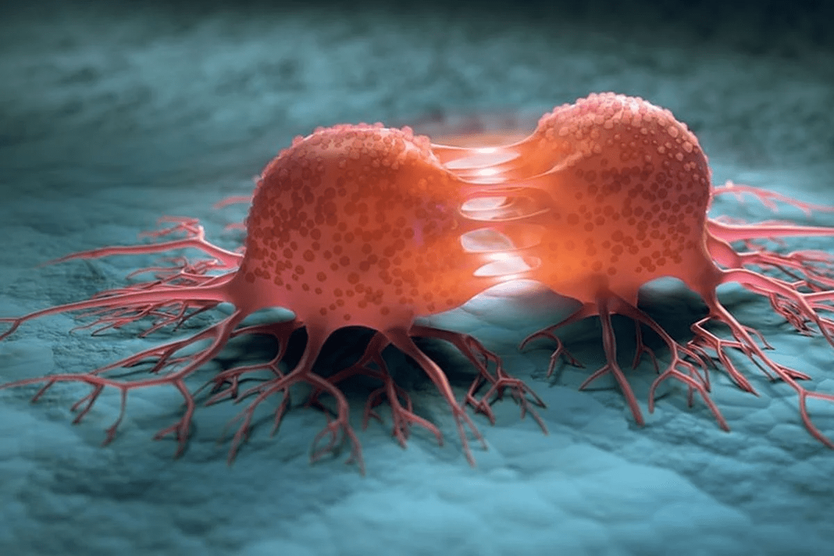 Malignant Melanoma on Head: Key Signs