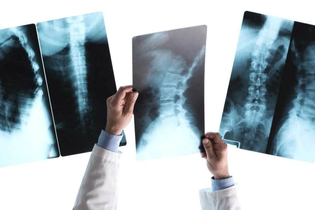 Will a CT Scan Show Broken Bones? 7 Key Facts 1 Will a CT Scan Show Broken Bones? 7 Key Facts