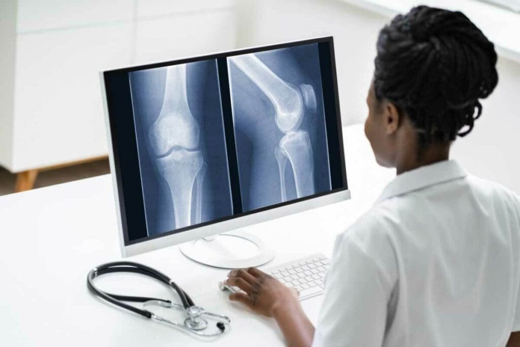 Will a CT Scan Show Broken Bones? 7 Key Facts 3 Will a CT Scan Show Broken Bones? 7 Key Facts