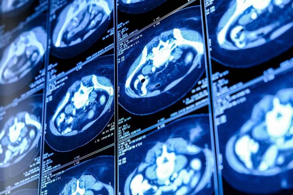 Contrast Drink: What to Know Before Your CT Scan 3 Contrast Drink: What to Know Before Your CT Scan