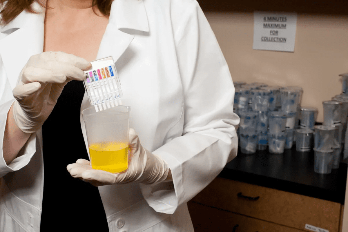 Can a Urine Test Detect Liver Problems via Bilirubin?