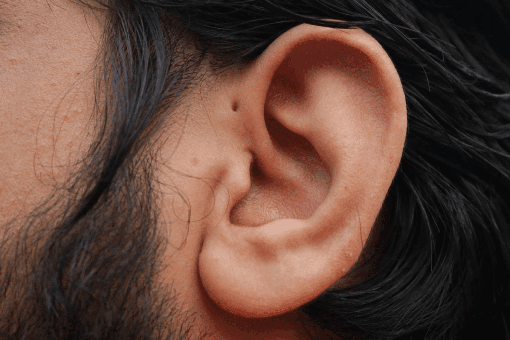 Ear Warm: Causes and How to Cool Down 3 Ear Warm: Causes and How to Cool Down