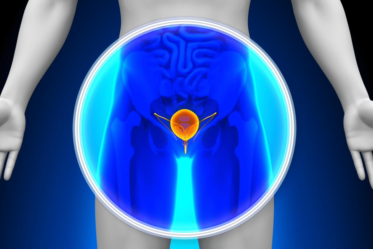 Pelvic MRI: Is a Full Bladder Needed?