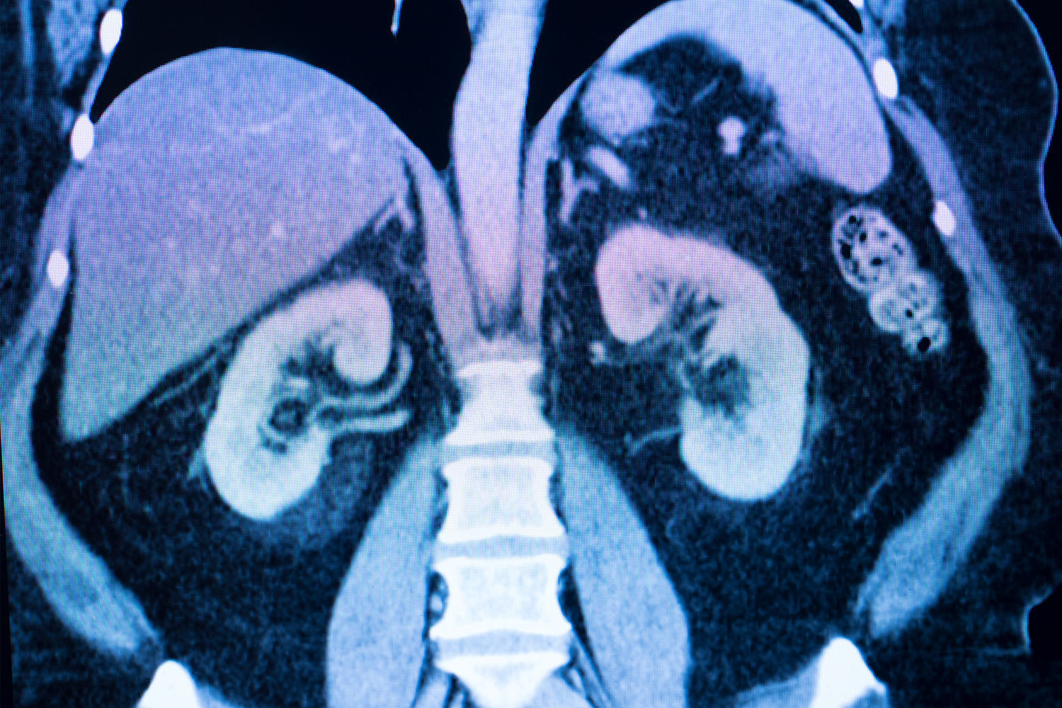 Kidney MRI: How Long Does It Take?