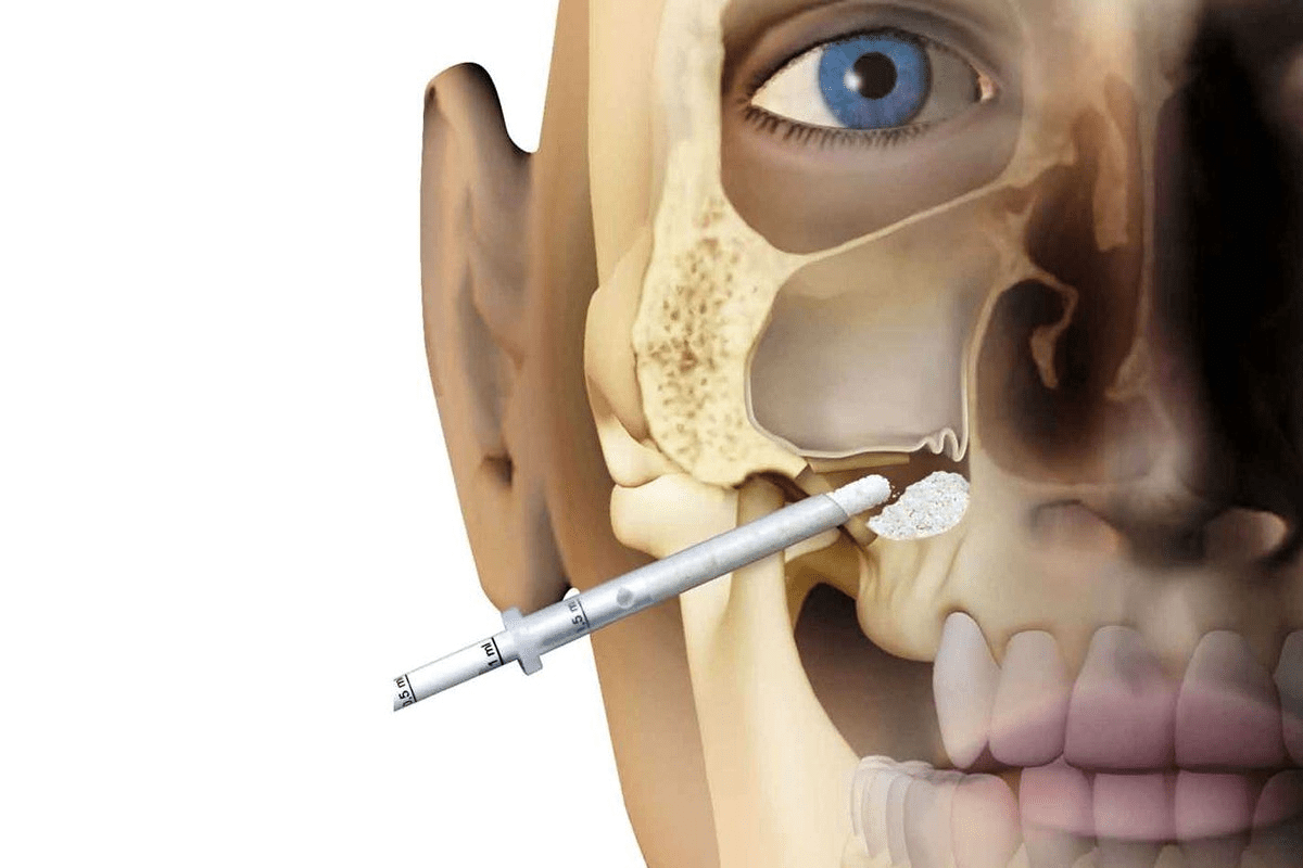 Nose Stuffy Throat Dry: Relief for Sinuses and Throat