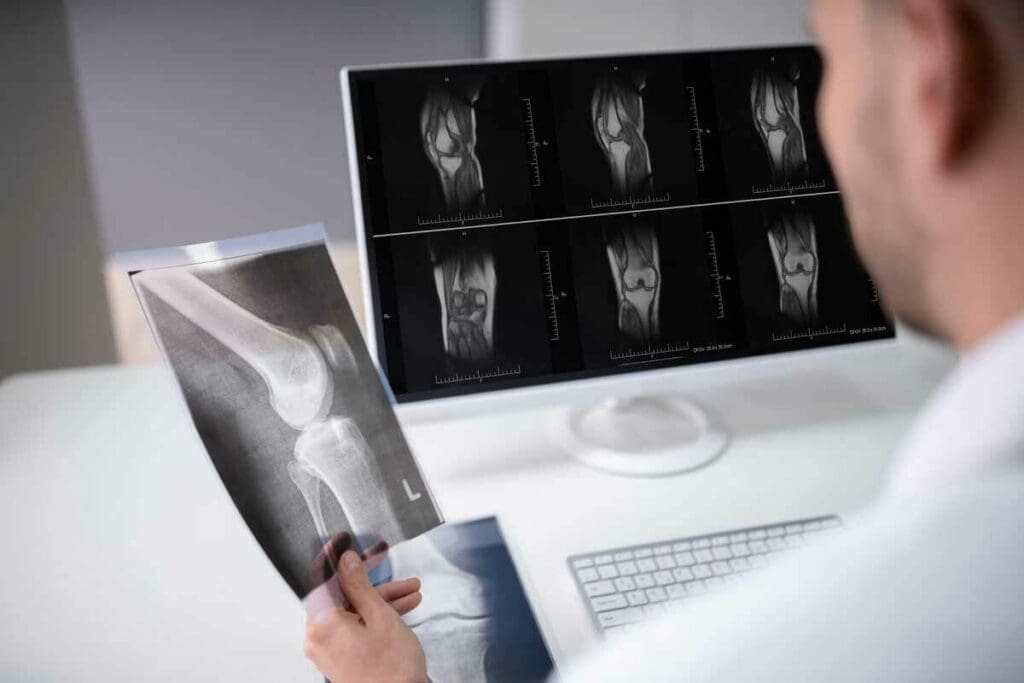 Are CAT Scans and Bone Scans the Same Thing? 1 Are CAT Scans and Bone Scans the Same Thing?