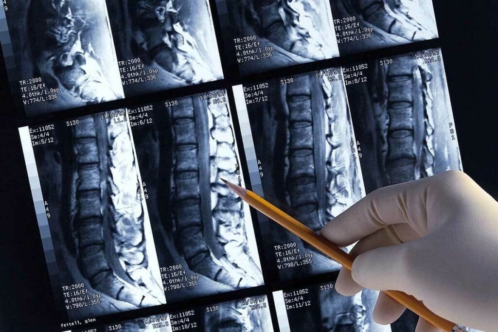 Are CAT Scans and Bone Scans the Same Thing? 2 Are CAT Scans and Bone Scans the Same Thing?