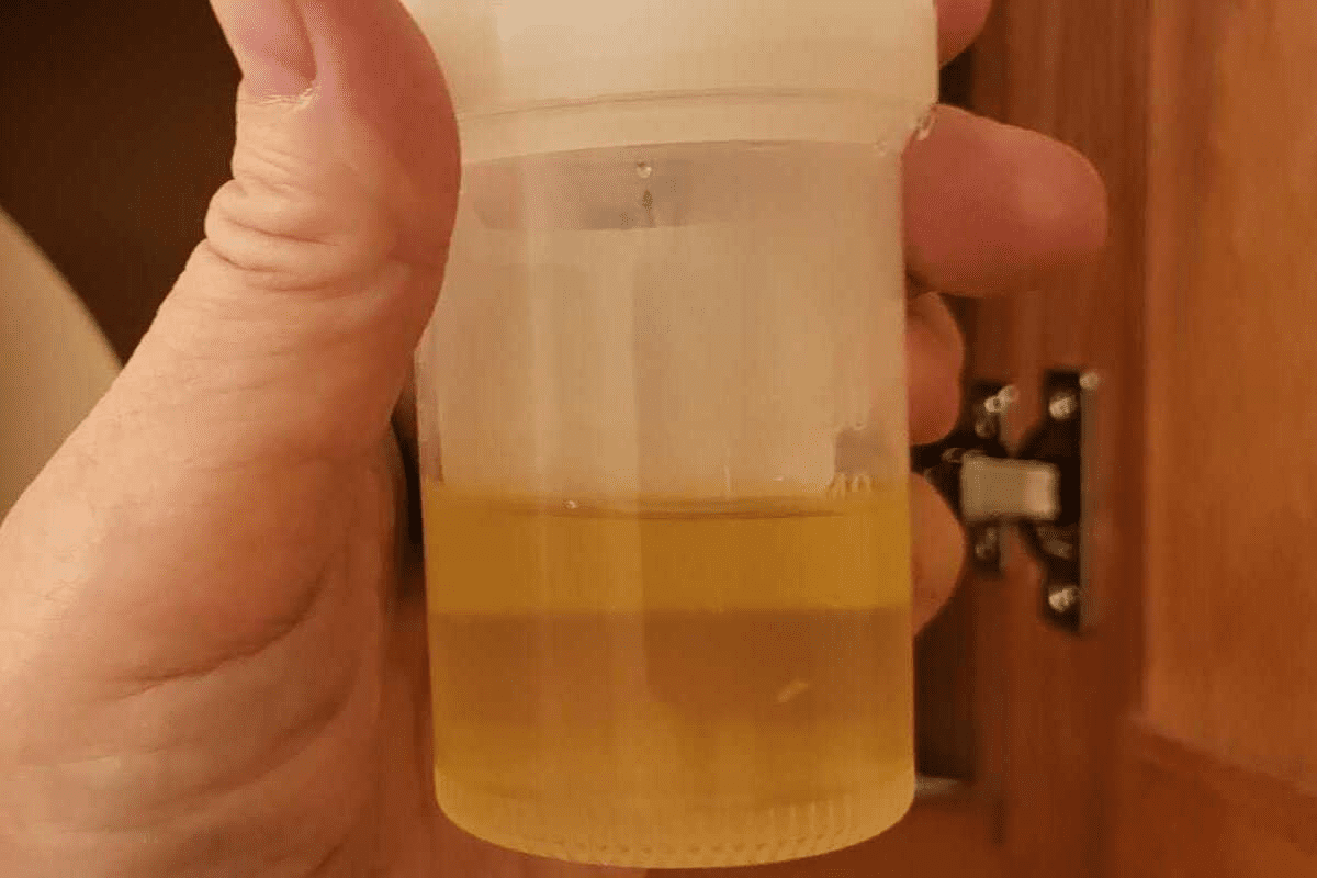 Pink Urine: 7 Common Causes Explained