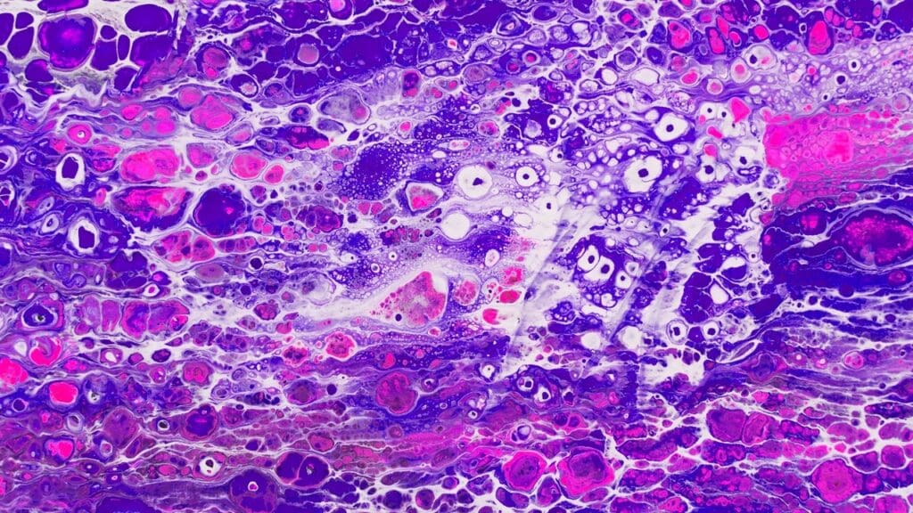 8 Common Types of Cancer B Cell Lymphoma and Their Key Features 3 image 2590 LIV Hospital