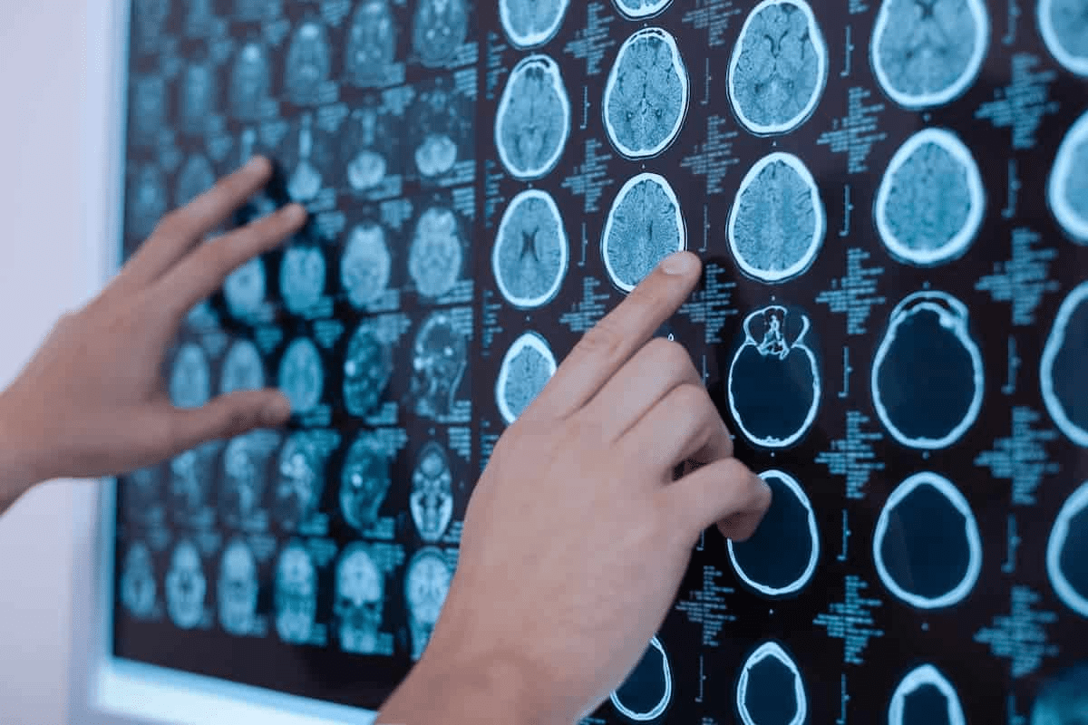 Childhood Brain Tumors Symptoms