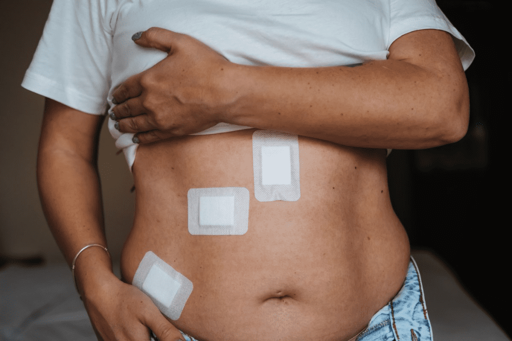 Bladder Sling Recovery: Can You Safely Walk After Surgery? 1 Bladder Sling Recovery: Can You Safely Walk After Surgery?