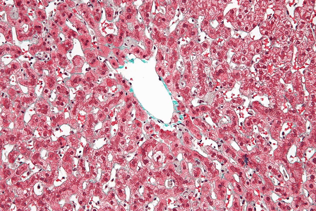 Hepatoblastoma Biopsy: Key Reasons Why It's Absolutely Needed