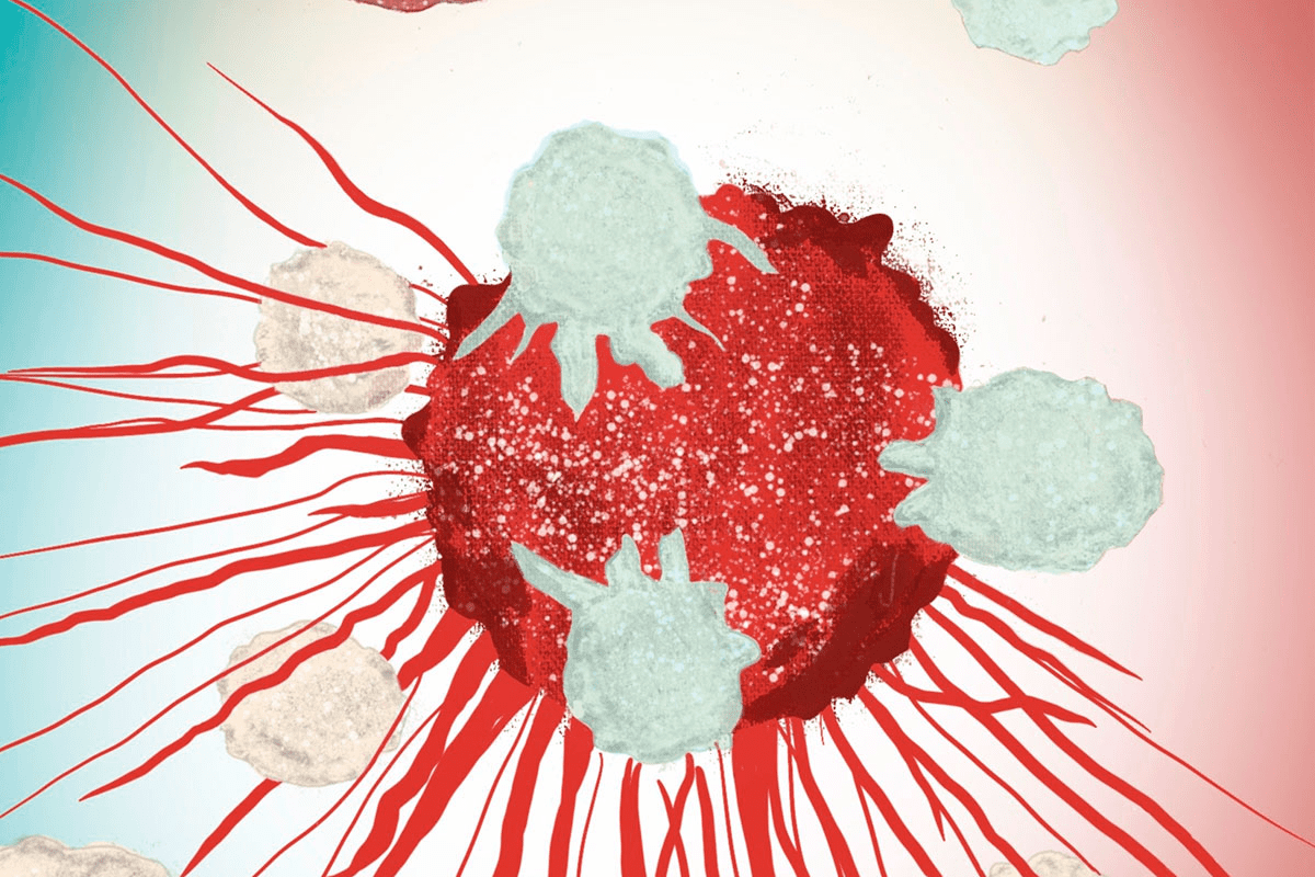 Neuroblastoma Staging Explained: Hope for Stage 4 Patients