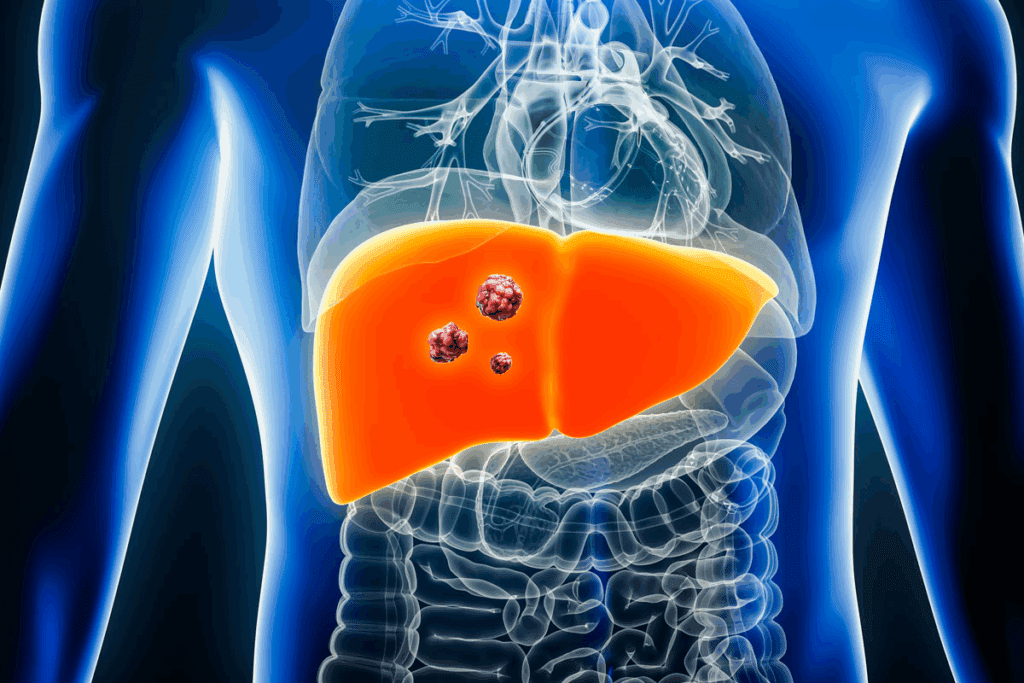 Hepatoblastoma Diagnosis: Key Tests for Quick and Accurate Results