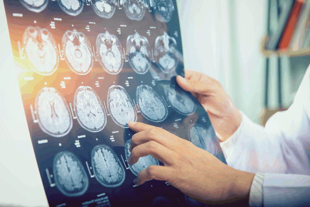 Rhabdomyosarcoma Rare Disease: Critical Facts on Scary Incidence