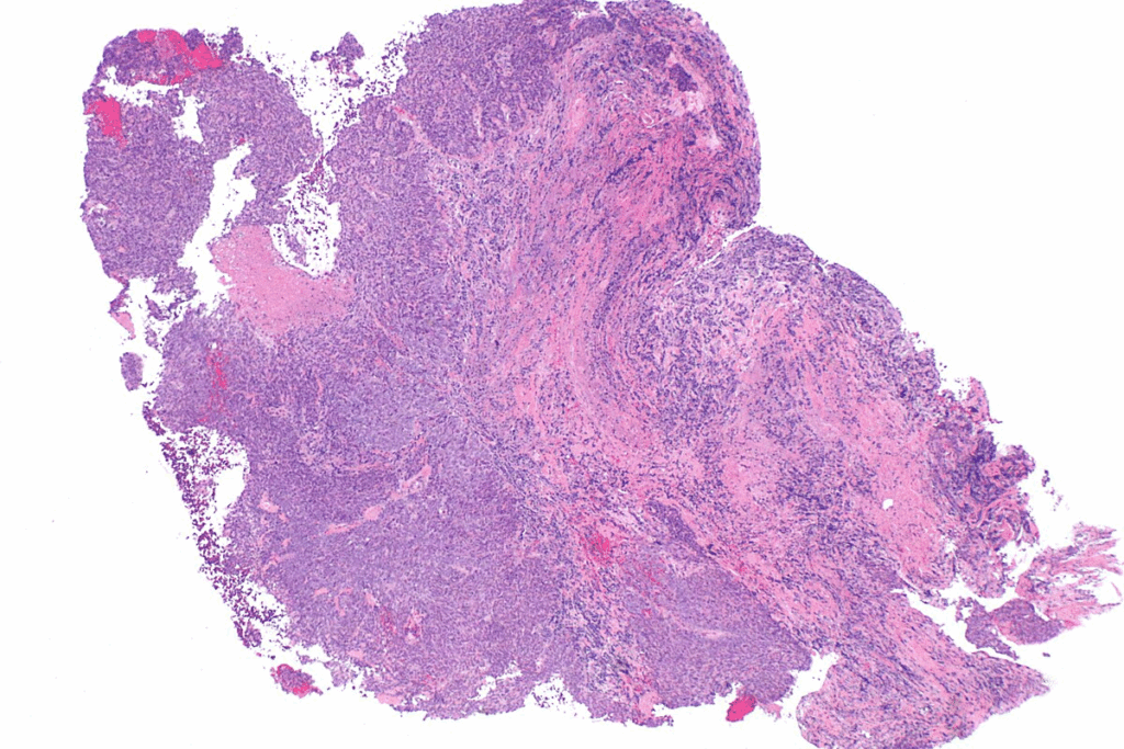 Define Renal Medulla: An Essential Guide