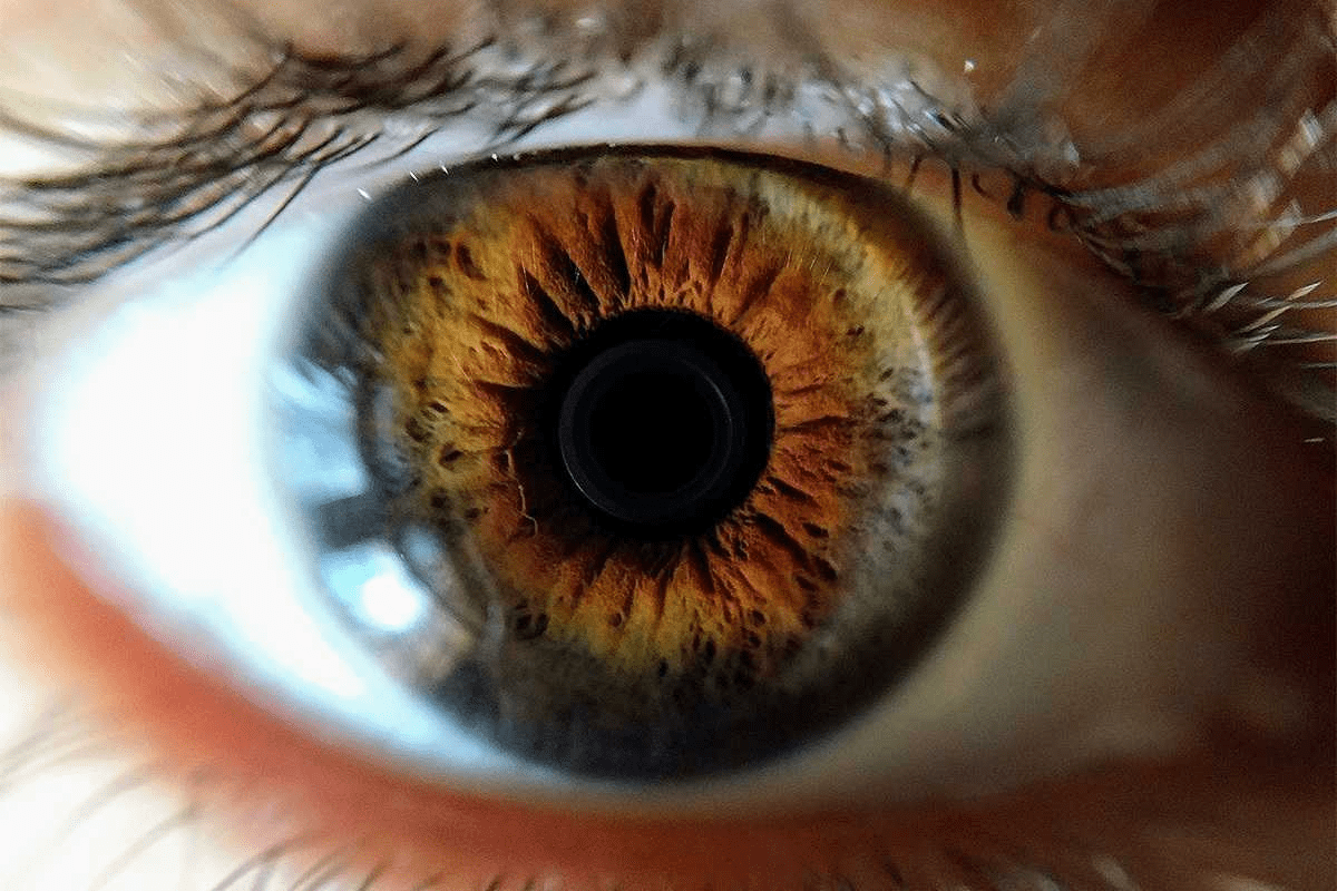 Retinoblastoma Prognosis: Benign Mimics and Hope