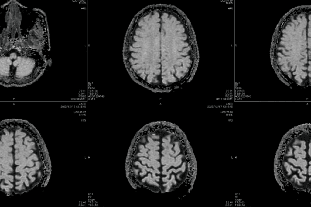 Solid Tumor Diagnosis 1 Solid Tumor Diagnosis