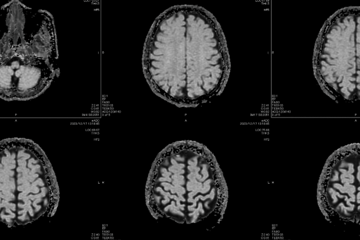 Solid Tumor Diagnosis