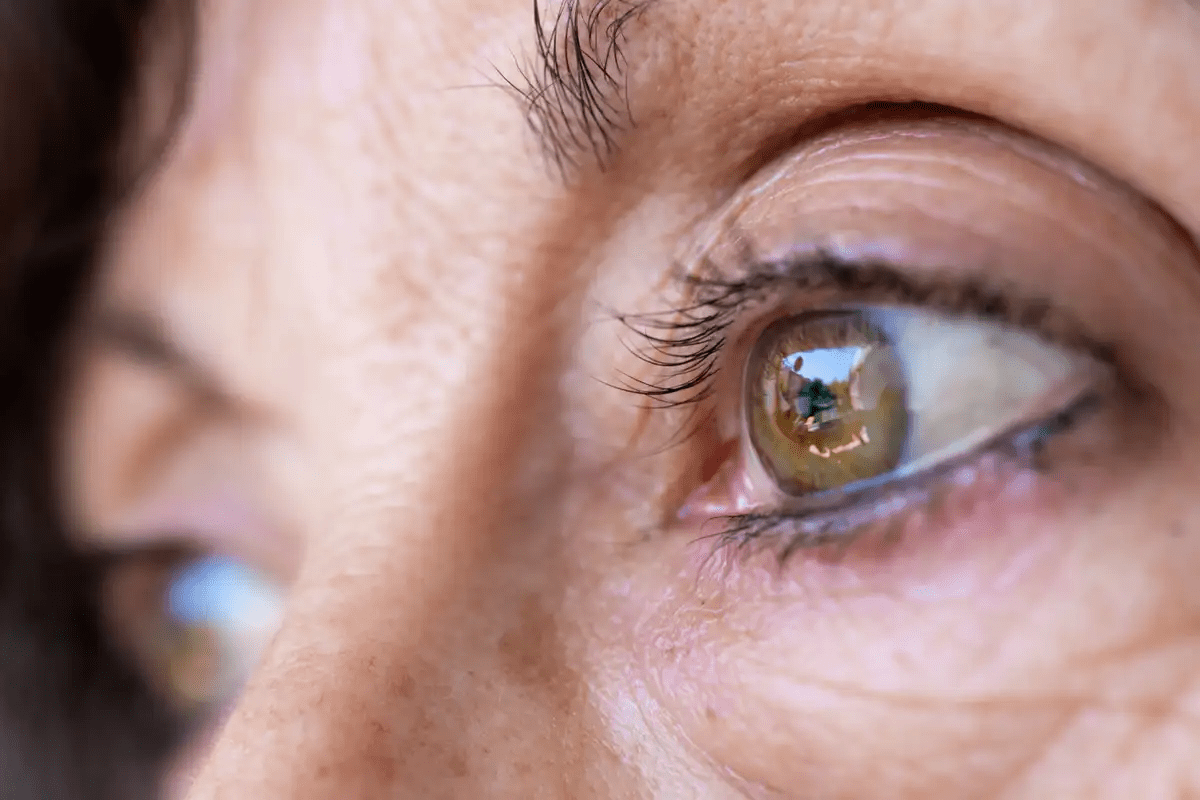 Recognizing eye cancer symptoms for Tumors Behind the Eye