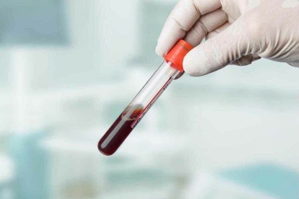 Acute Leukemia Blood Test: 5 Essential Tests for Accurate Diagnosis 1 Acute Leukemia Blood Test: 5 Essential Tests for Accurate Diagnosis