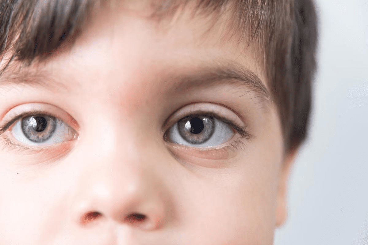 Methods for Early Detection of Retinoblastoma by Parents and Doctors