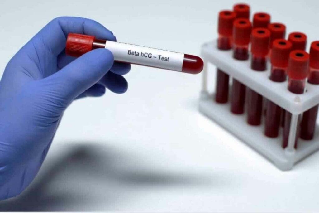 Acute Leukemia Blood Test: 5 Essential Tests for Accurate Diagnosis 3 Acute Leukemia Blood Test: 5 Essential Tests for Accurate Diagnosis