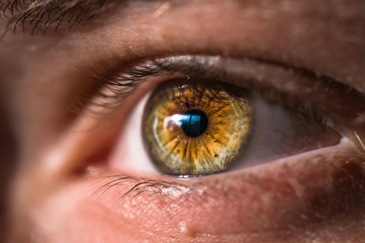 Factors in Retinoblastoma Aggressiveness Assessment and Staging