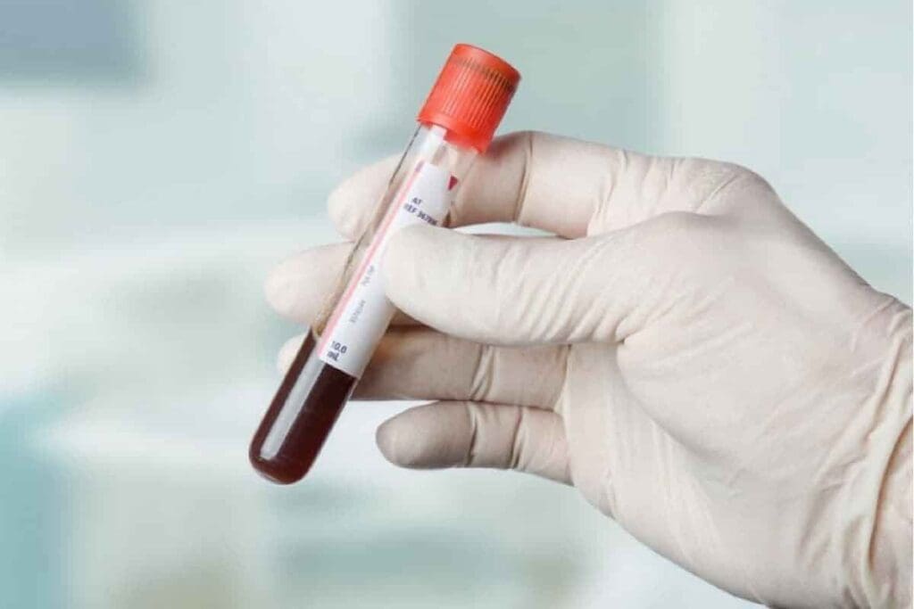 Chronic Anemia: 9 Key Hemoglobin Levels and Their Long-Term Effects